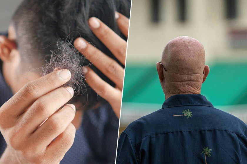 Llevamos años escuchando que lavarse demasiado el pelo provoca que se te caiga. Es exactamente al revés Llevamos años escuchando que lavarse demasiado el pelo provoca que se te caiga. Es exactamente al revés